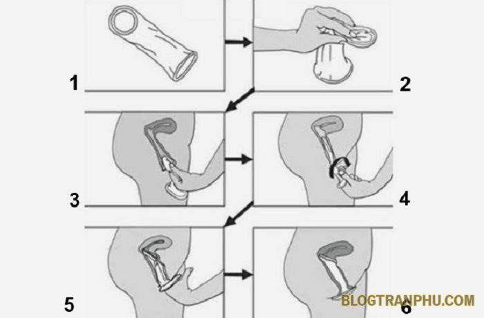 Cách sử dụng bao cao su cho nữ giới