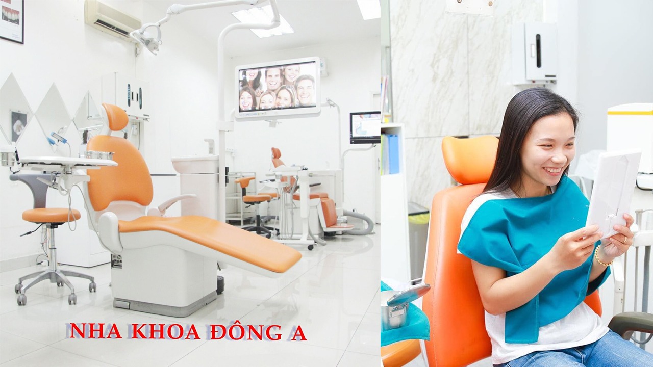 TỔNG HỢP 11 NHA KHOA ĐIỀU TRỊ CƯỜI HỞ LỢI TỐT NHẤT TPHCM