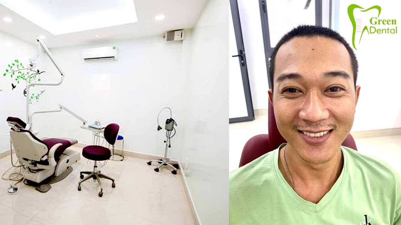 TỔNG HỢP 11 NHA KHOA ĐIỀU TRỊ CƯỜI HỞ LỢI TỐT NHẤT TPHCM