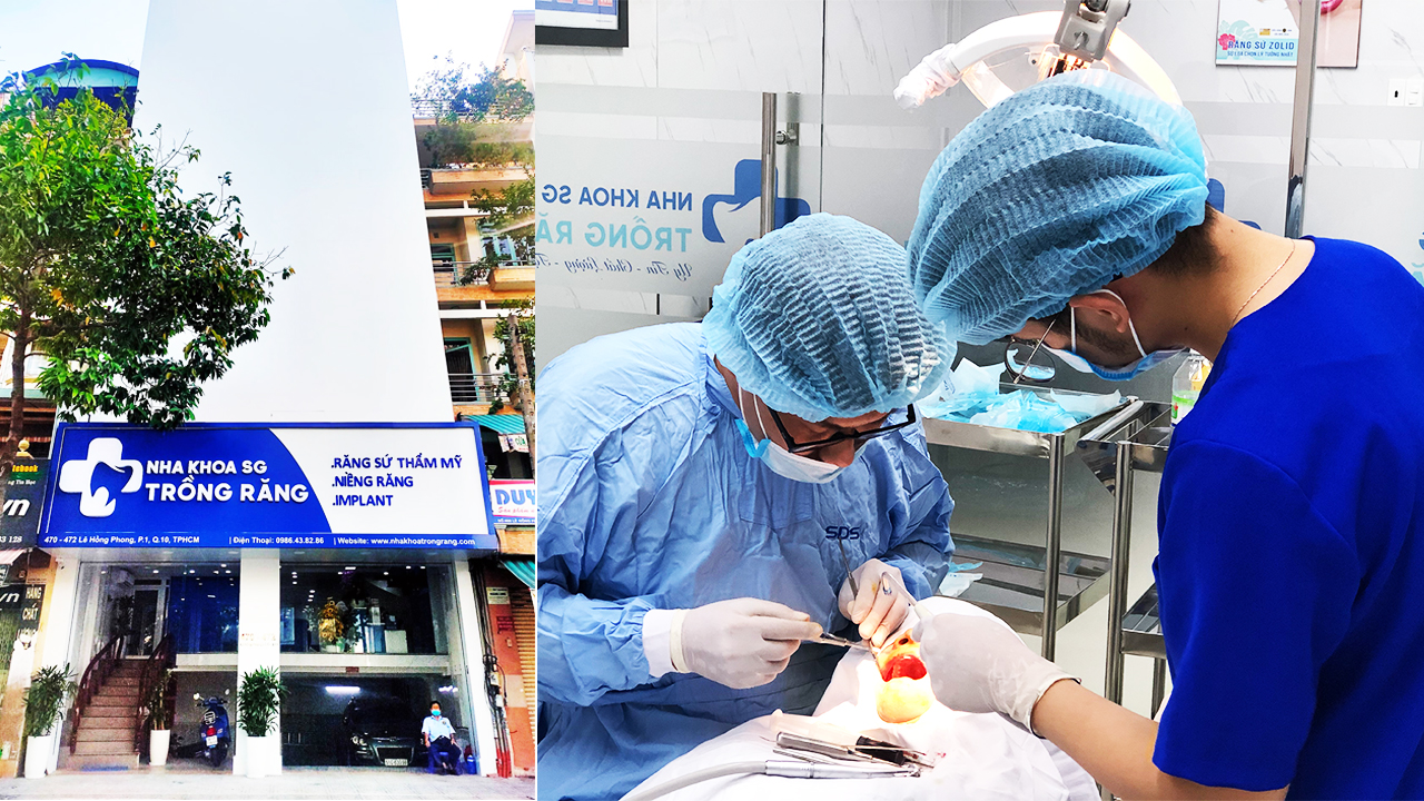 TỔNG HỢP 11 NHA KHOA ĐIỀU TRỊ CƯỜI HỞ LỢI TỐT NHẤT TPHCM