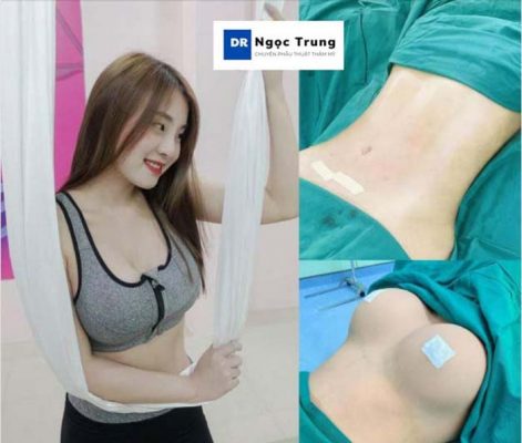 Trở về thời con gái cùng Phù thủy combo ngực bụng Dr Ngọc Trung