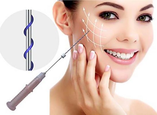 Căng da mặt bằng chỉ là gì?