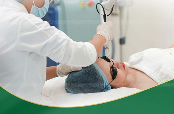 Đốt mụn thịt là công nghệ gì, có hiệu quả không?