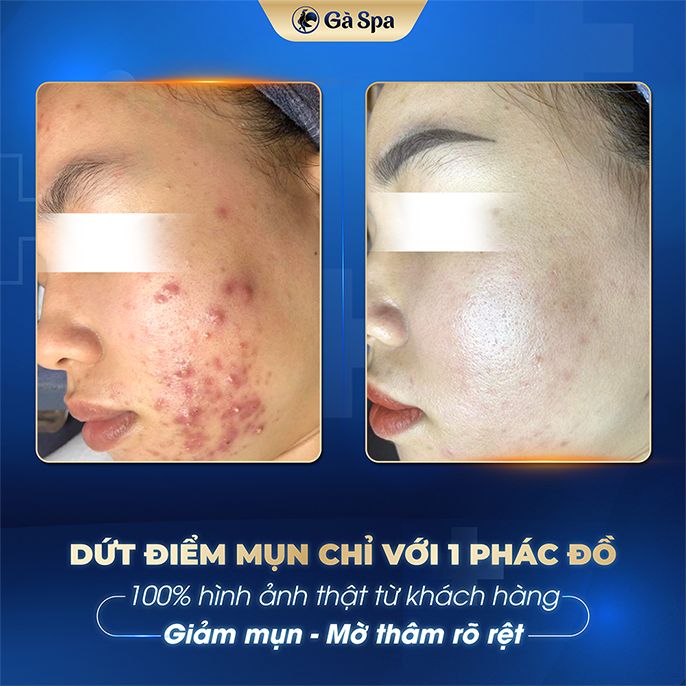 Review Gà spa và Bảng giá Gà spa mới nhất hiện nay