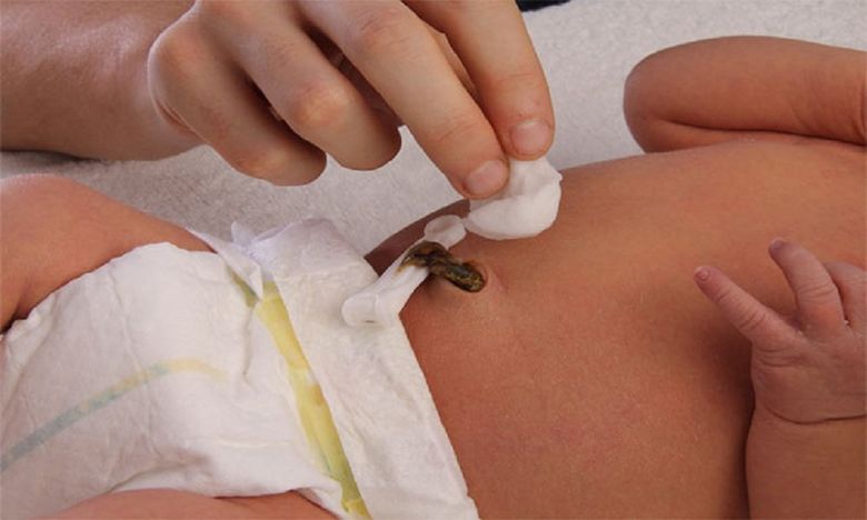 Dấu hiệu bé sắp rụng rốn và cách chăm sóc cuống rốn đúng cách